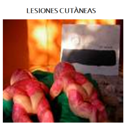 Describe las características, patogenicidad, vías de transmisión y prevención. Staphylococcus y Streptococcus.