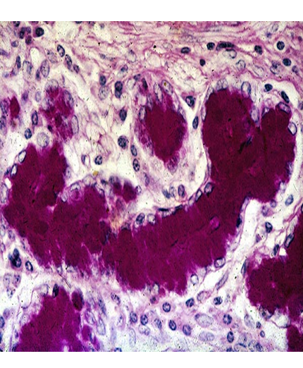 Describe las características, patogenicidad, vías de transmisión y prevención. Staphylococcus y Streptococcus.
