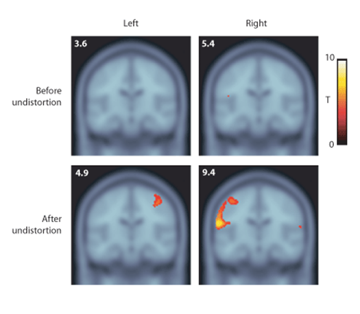 Definiciones de la Neuropsicología. 