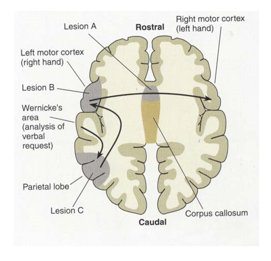 Definiciones de la Neuropsicología. 