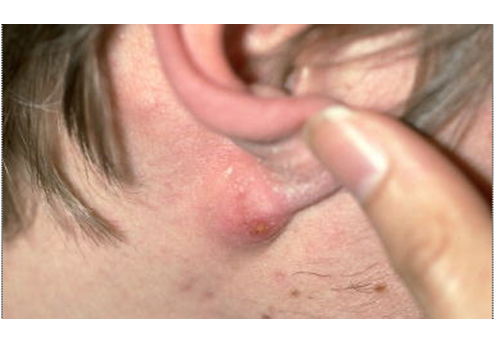 Describe las características, patogenicidad, vías de transmisión y prevención. Staphylococcus y Streptococcus.