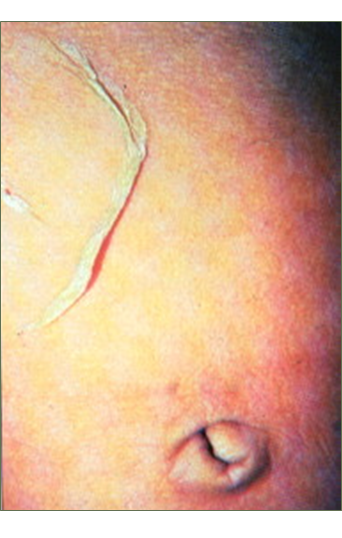 Describe las características, patogenicidad, vías de transmisión y prevención. Staphylococcus y Streptococcus.