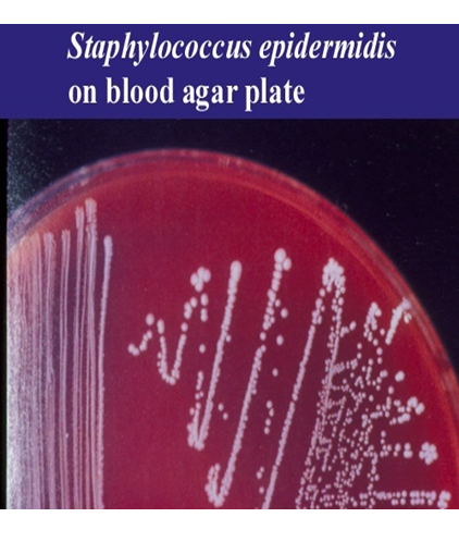 Describe las características, patogenicidad, vías de transmisión y prevención. Staphylococcus y Streptococcus.