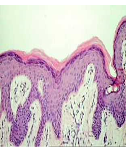 Describe las características, patogenicidad, vías de transmisión y prevención. Staphylococcus y Streptococcus.