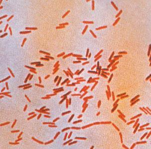Campylobacter, Yersinia y Helicobacter pylori.